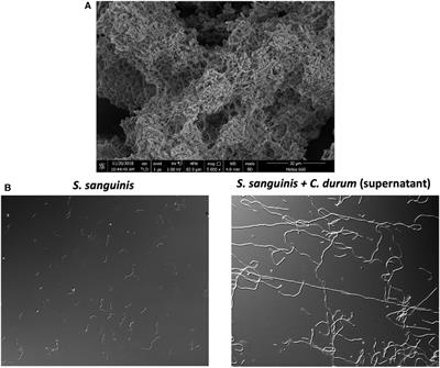 Molecular commensalism: how oral corynebacteria and their extracellular membrane vesicles shape microbiome interactions